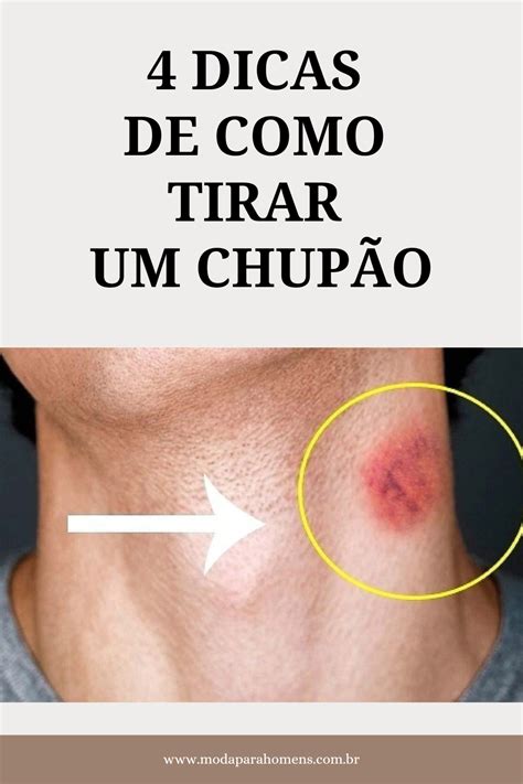 como tirar um chupao|Como Tirar um Chupão: Dicas Eficazes e Rápidas